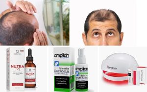 What a Man should do to cure Baldness